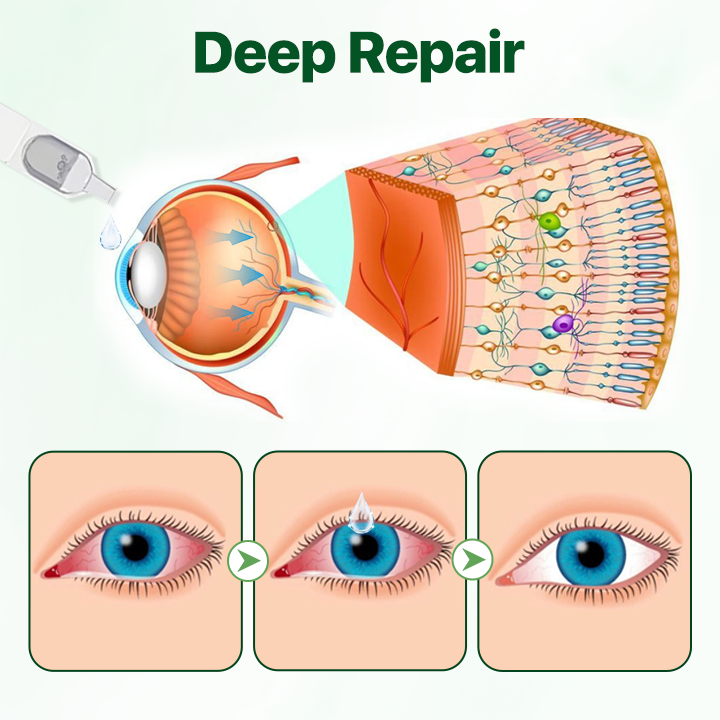 Biancat® Vision Enhancing Multifunctional Eye Drops-(A)