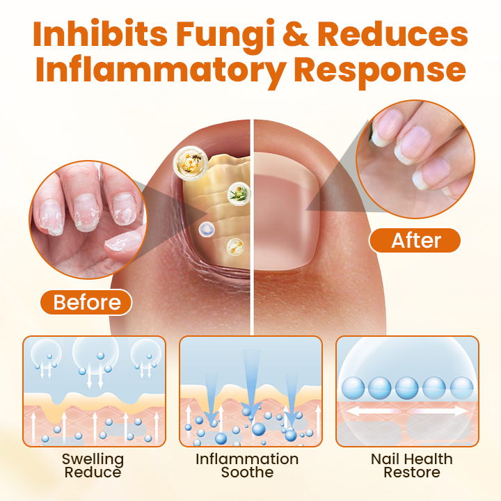 Timilk® FungiBee Advanced Nail Repair Spray (A)