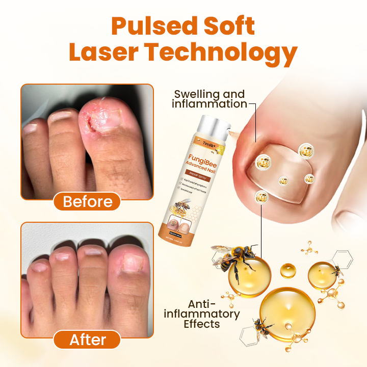 Timilk® FungiBee Advanced Nail Repair Spray (A)