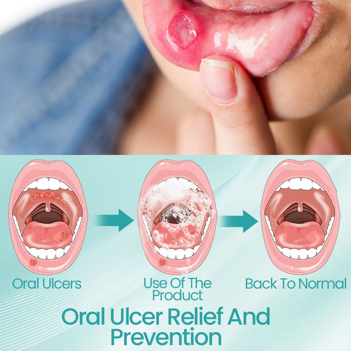 Ceoerty® RadiantSmile Oral Rinse (A)