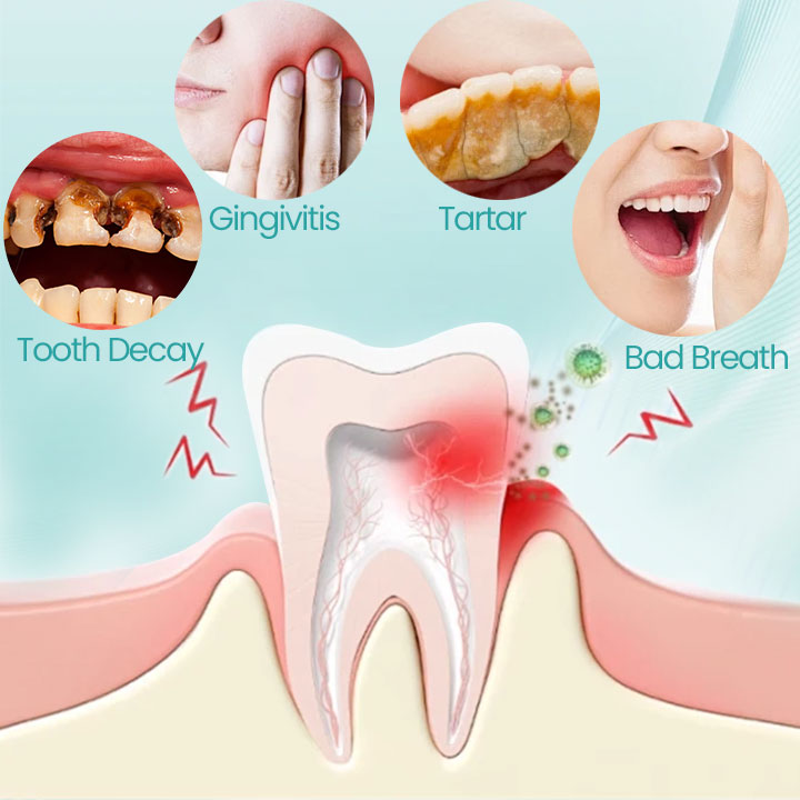 Ceoerty® RadiantSmile Oral Rinse (A)