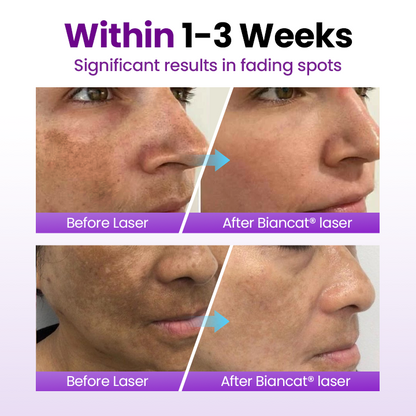 Biancat® SpotErase Probiotic Shield Serum (A)