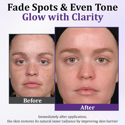 Ceoerty® PigmentaX ProFade Anti-Hyperpigmentation Cream (A)