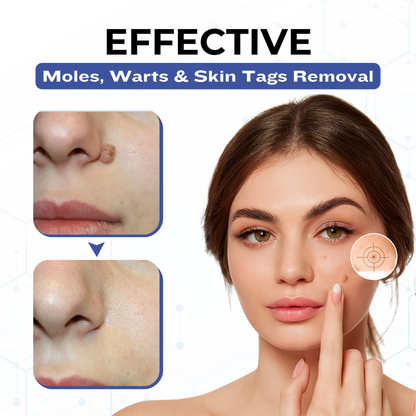 Timilk® VanishPro Skin Spot Removal Cream