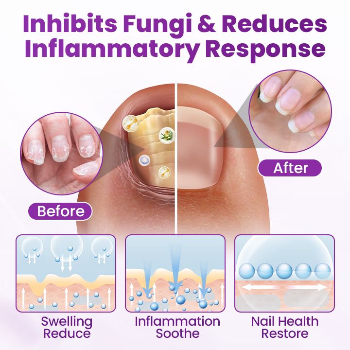 Timilk® AeroFilm Foot Defense Mist